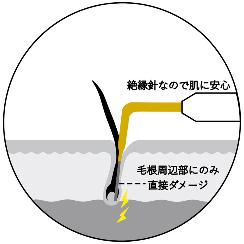 医療針
