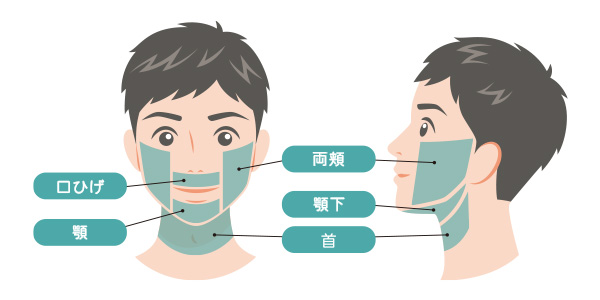 男性ひげ脱毛