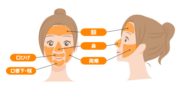 女性かお脱毛